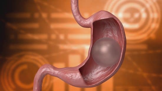ballon-gastrique-3D