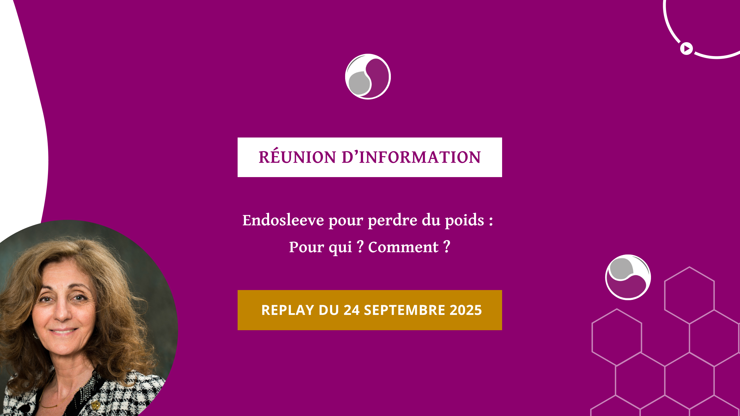 Réunion réunion du 24 septembre 2025. Perte de poids durable avec l’endosleeve : le témoignage de Julie après 5 ans !